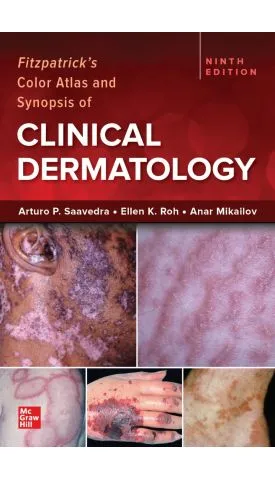 Fitzpatricks-Color-Atlas-and-Synopsis-of-Clinical-Dermatology-9th-Edition-LyIKI