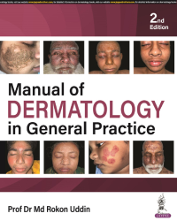 Manual-of-Dermatology-in-General-Practice-2nd-Edition-el4sE