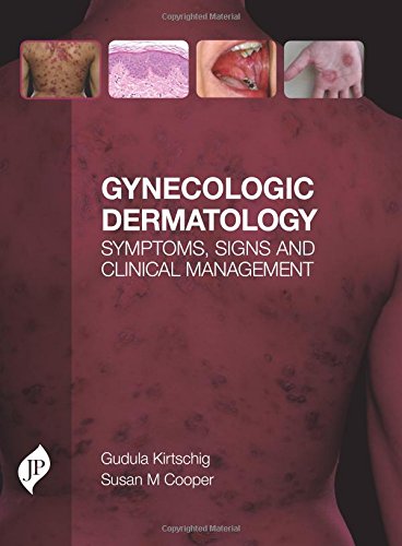Gynecologic-Dermatology-Symptoms-Signs-and-Clinical-Management-1st-Edition-SZqSG