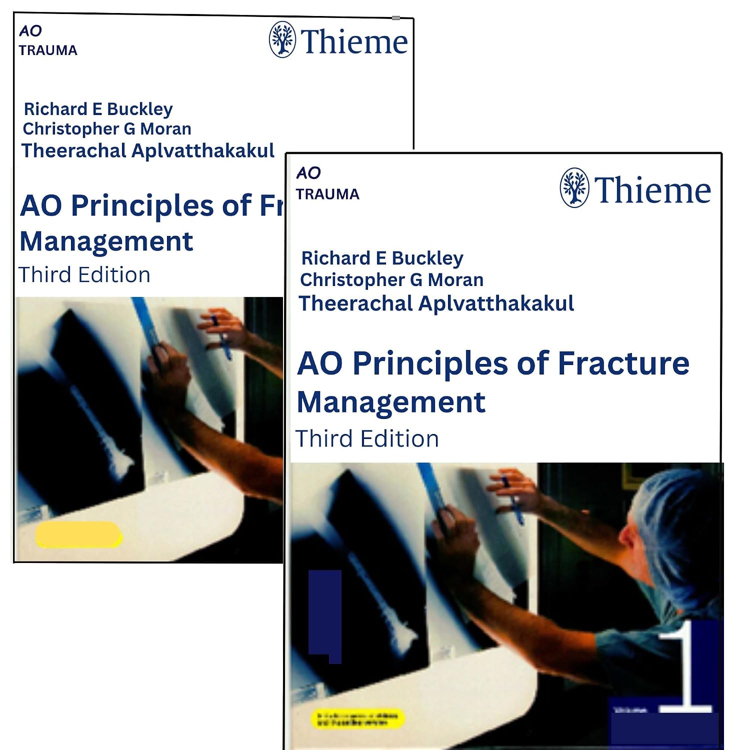 AO-Principles-of-Fracture-Management-3rd-Edition-2-Volume-Set-cdzEo