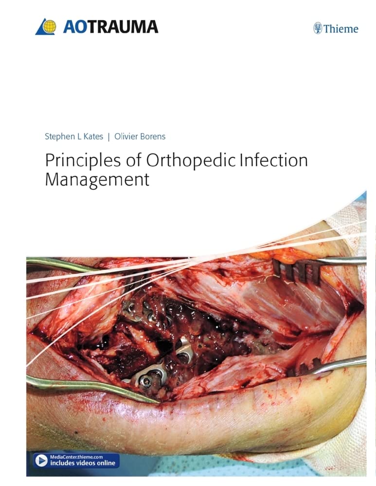 Principles-of-Orthopedic-Infection-Management-1st-Edition-ltsGM